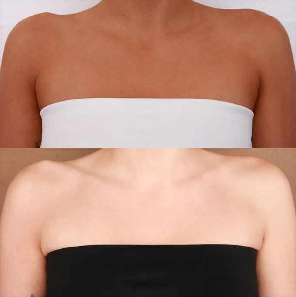 Burleigh Bronze Solution